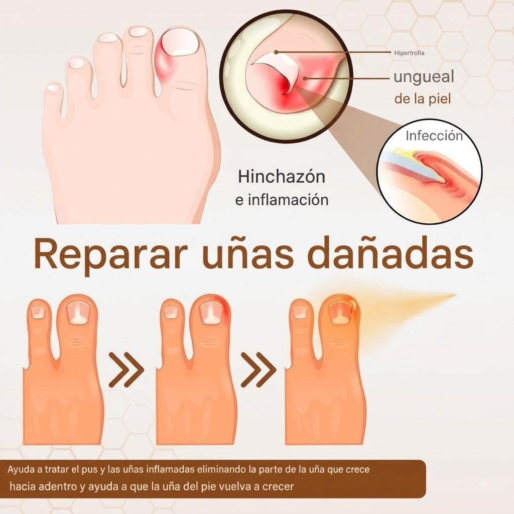 TerbiFin Pro|Spray Anti-Hongos-Picazón 100 ml|Promo 2x1