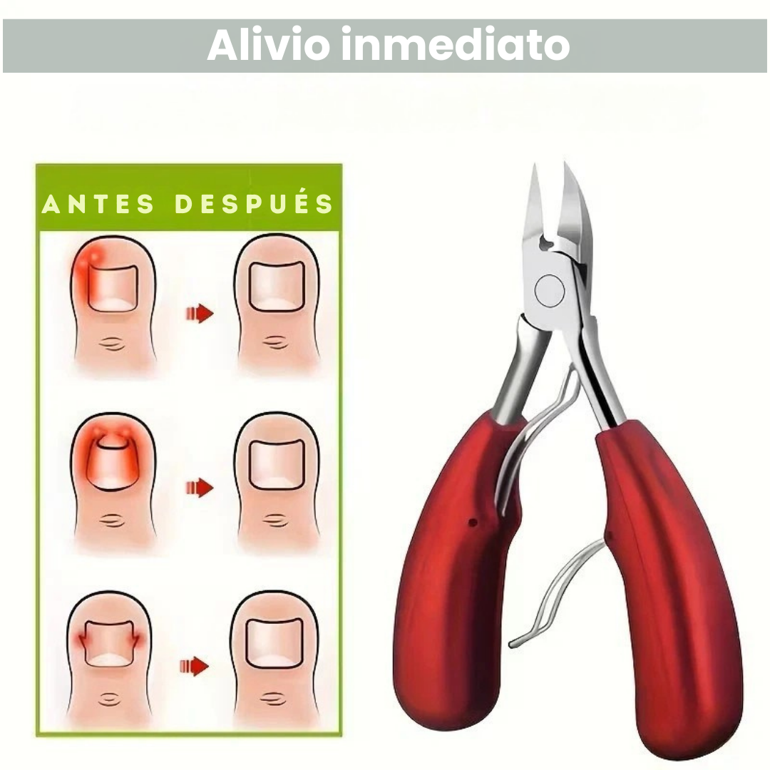 Cortaúñas Profesional – Uñas difíciles sin sufrir