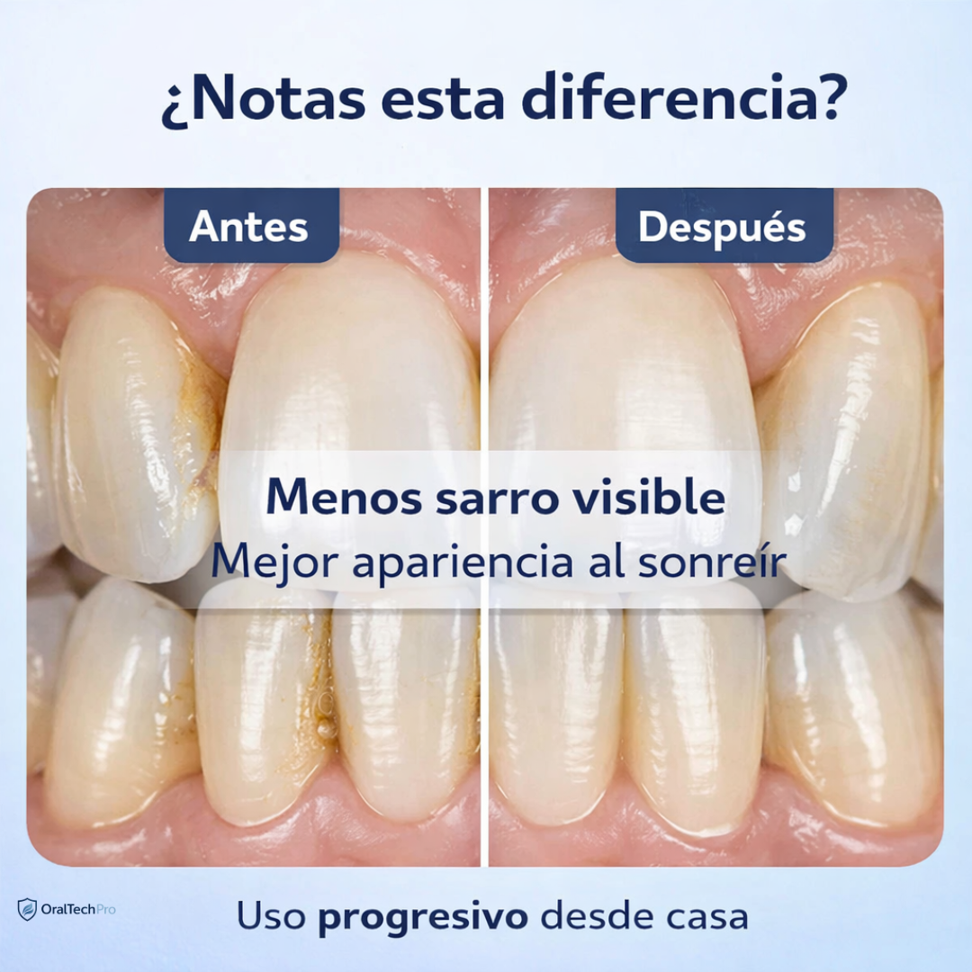 OralTech Pro- Elimina el sarro en minutos