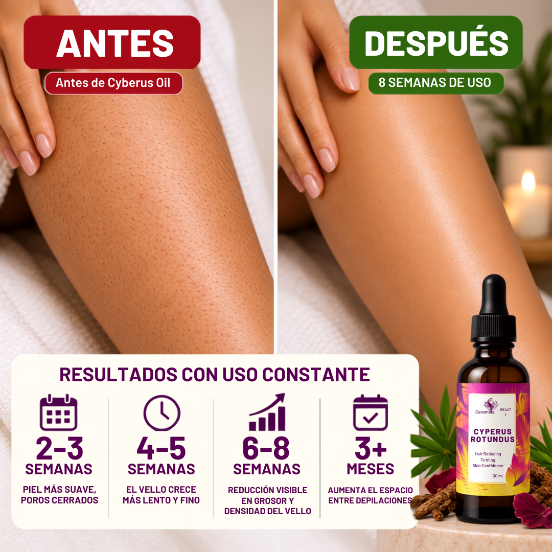 Cyperus Rotundus Oil™ | Aceite para el Cuidado Corporal – 2x1