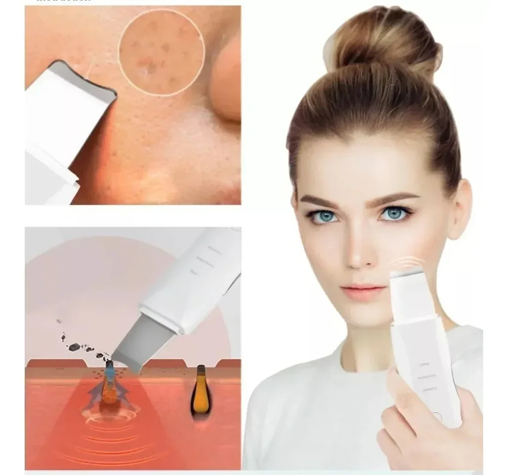 ClearFace Pro™ - Piel limpia sin puntos negros