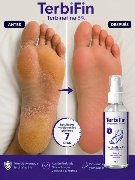 TerbiFin Pro|Spray Anti-Hongos-Picazón 100 ml|Promo 2x1